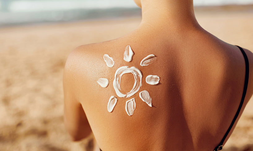 How to calm a prickly heat rash flare-up image